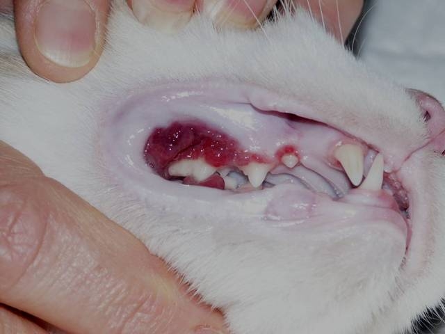 maladie-dentaire2